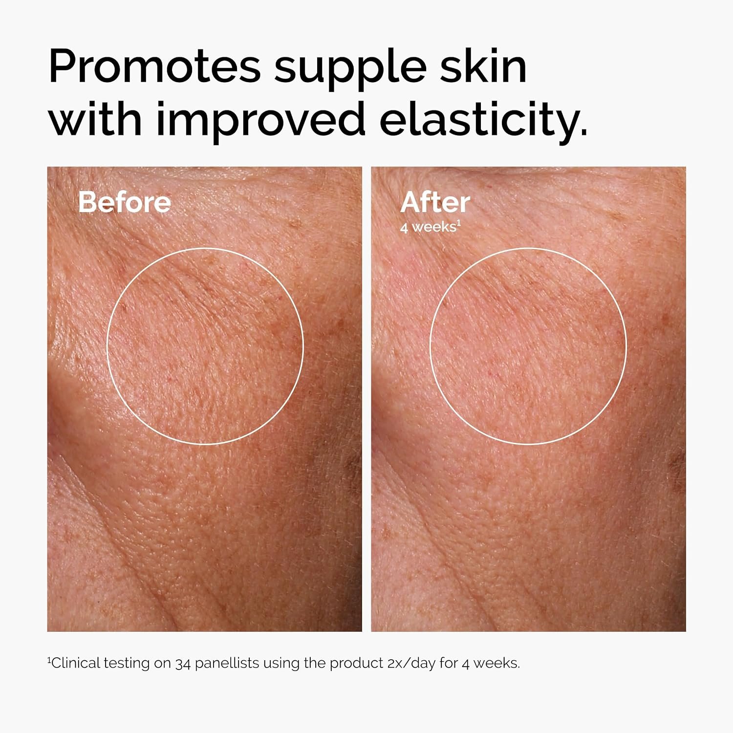 The Ordinary Hyaluronic Acid 2% + B5 (with Ceramides), Multi-Depth Hydration Serum for Plumper, Smoother & Hydrated Skin - Image 5