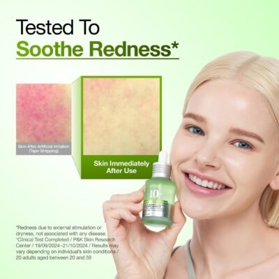 Anua Azelaic Acid 10 Hyaluron Redness Soothing Serum, Lightweight Blemish & Oil Care Facial Serum - Image 5