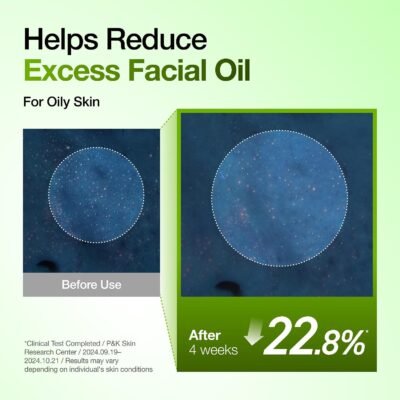 Anua Azelaic Acid 10 Hyaluron Redness Soothing Serum, Lightweight Blemish & Oil Care Facial Serum - Image 4