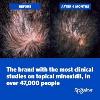 Men's Rogaine 5% Minoxidil Topical Foam, Unscented Hair Loss & Regrowth Treatment for Thicker Hair - Image 4