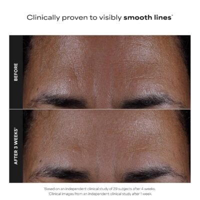 Paula's Choice SKIN PERFECTING 2% BHA Liquid Exfoliant, Gentle Salicylic Acid Facial Exfoliator for Blackheads, Enlarged Pores & Fine Lines - Image 9